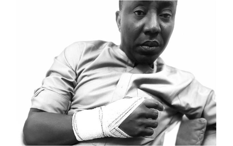 BREAKING: Nigerian Police breaks Omoyele Sowore’s arm in detention