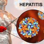 Earn 500k monthly as Talent45 announces Recruitment Drive for Accountants